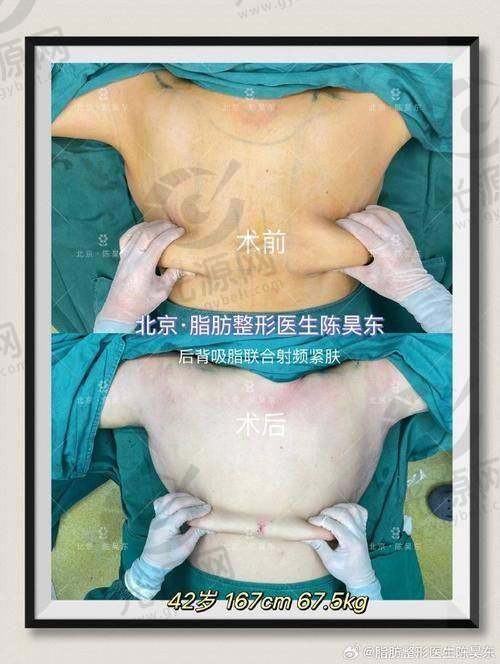 五、郑州抽脂比较好的医生预约挂号方式