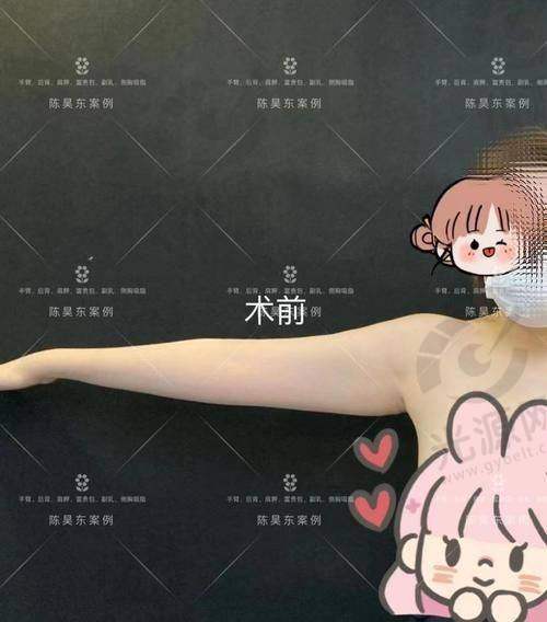 二、郑州抽脂比较好的医生详细介绍