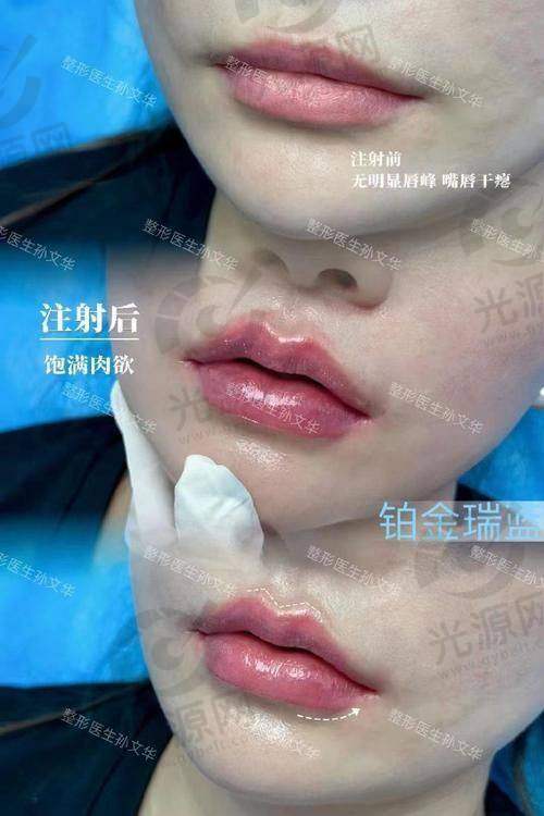 如何预约于晓强医生
