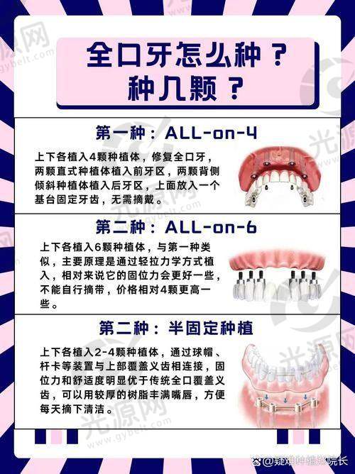 良心医生不建议种植牙的风险