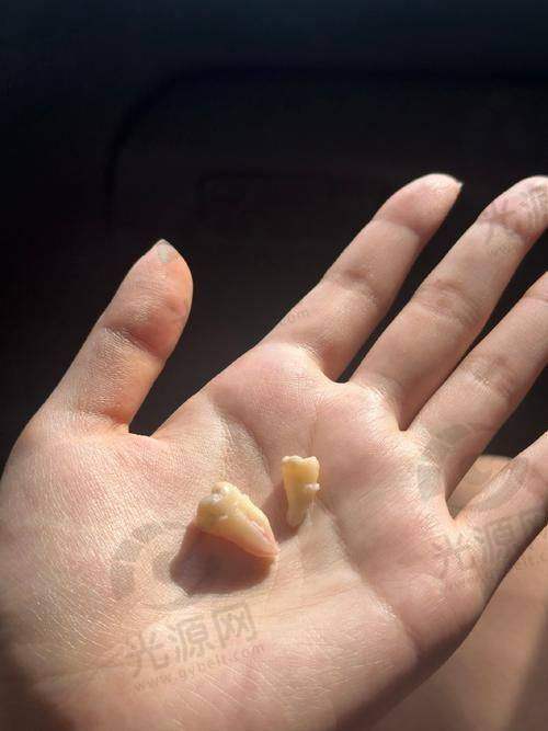 总结：拔智齿洞修复过程图解的重要性