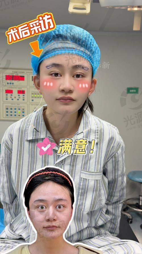 实际实例分享：贴发耳矫正的成功故事