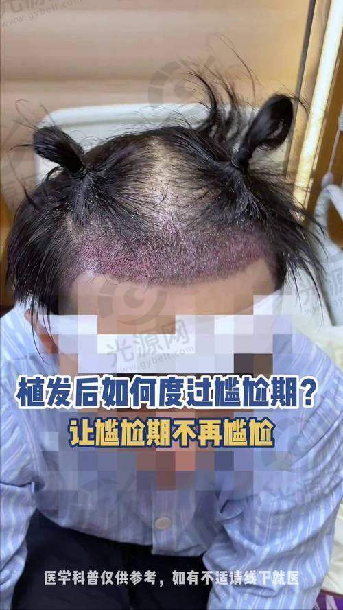 一、顺德壹加壹整形医院