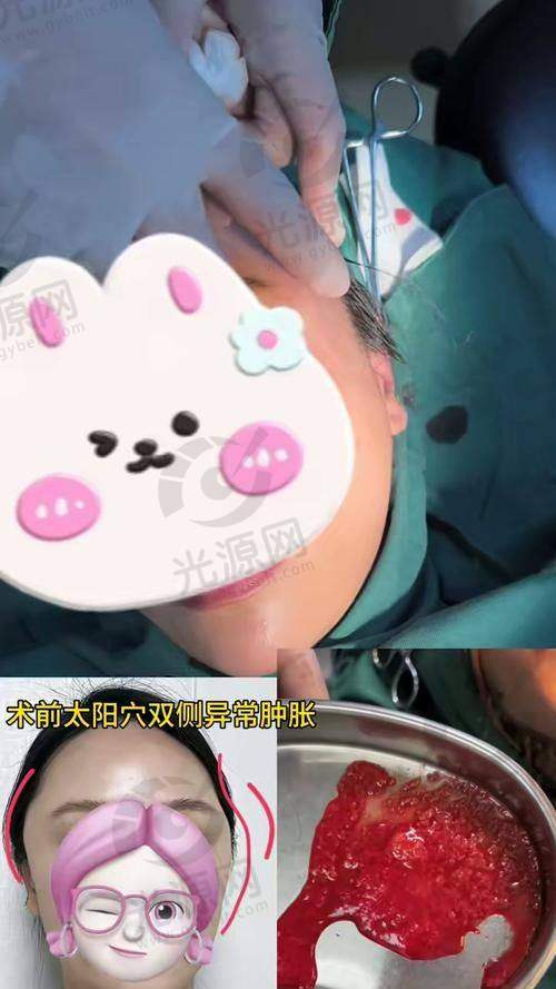 四、北京取生长因子的医生口碑评价