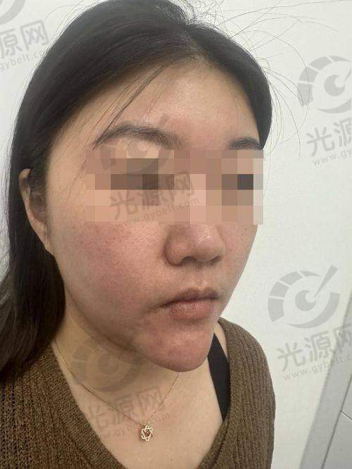 二、北京取生长因子的医生详细介绍