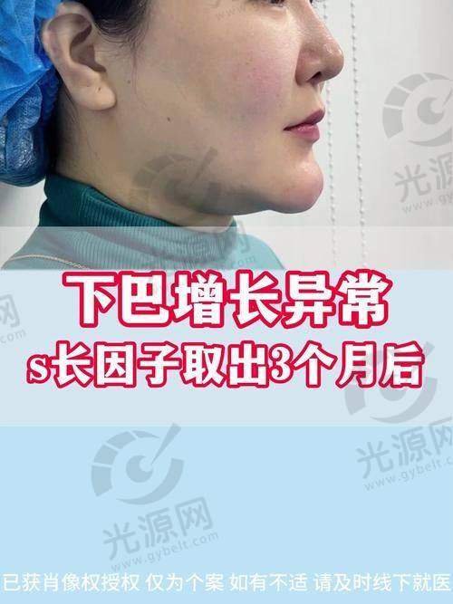 北京取生长因子的医生排名第3：郭鑫医生