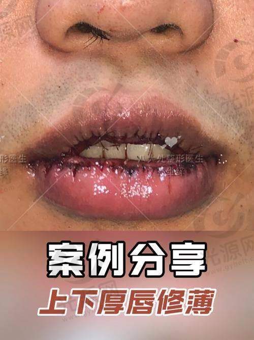 一、黛美医疗美容医院医生，专精资质与成就