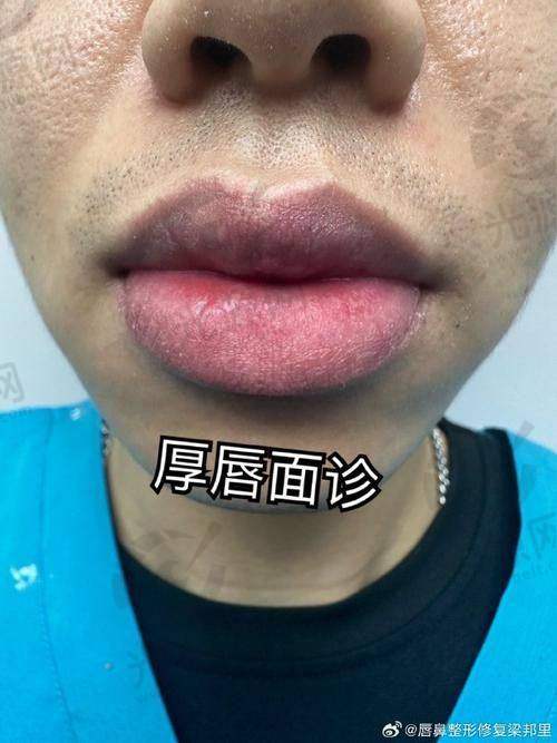 三、黛美医疗美容医院的客户真实评价