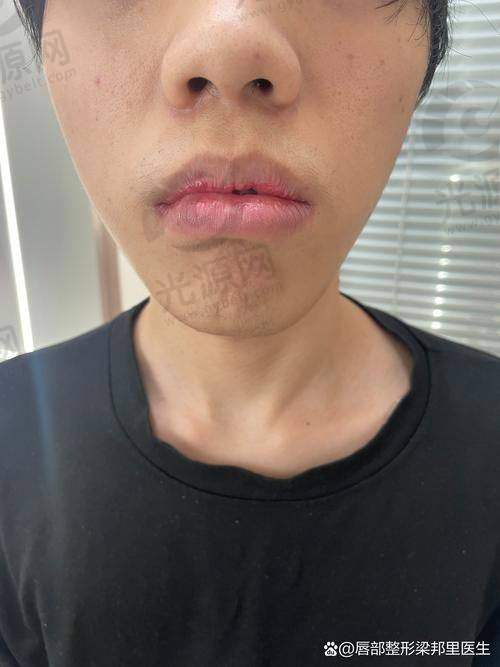 六、黛美医疗美容医院医生收费标准