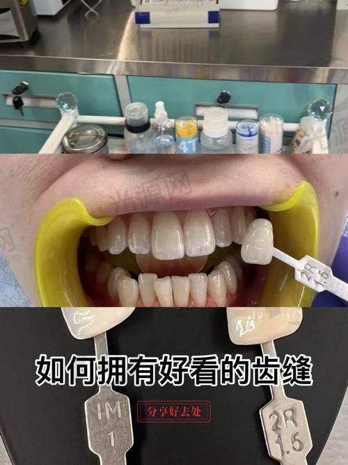 二、亳州三爱口腔的技术优势与擅长项目介绍