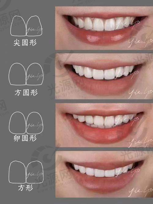 10.蒙城县贝德口腔- 省内交叉技术标杆