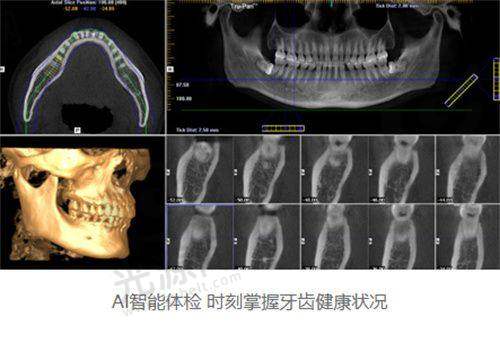 德国种植牙品牌与价格
