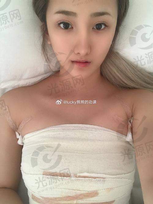 假体隆胸之后引流液的产生原因