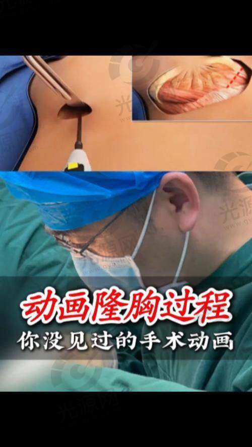 结论：假体隆胸之后的引流液吸收及护理总结