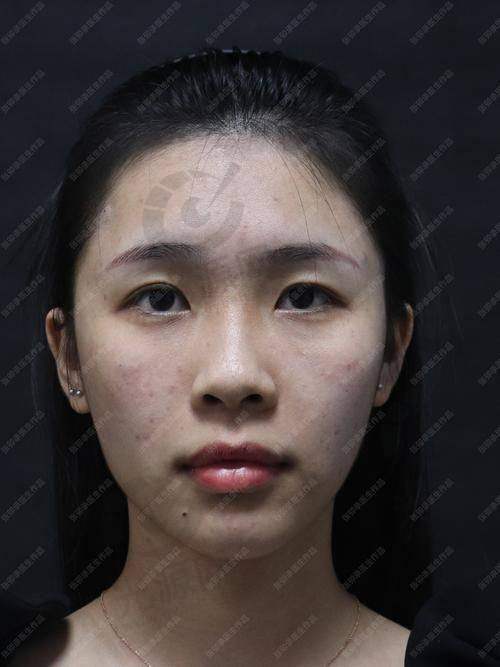 9. 韩国蜜瓜melon整形医院——前列科技的运用
