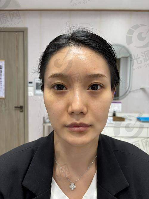 7. 韩国童颜整形医院——领跑的技术与个性化服务