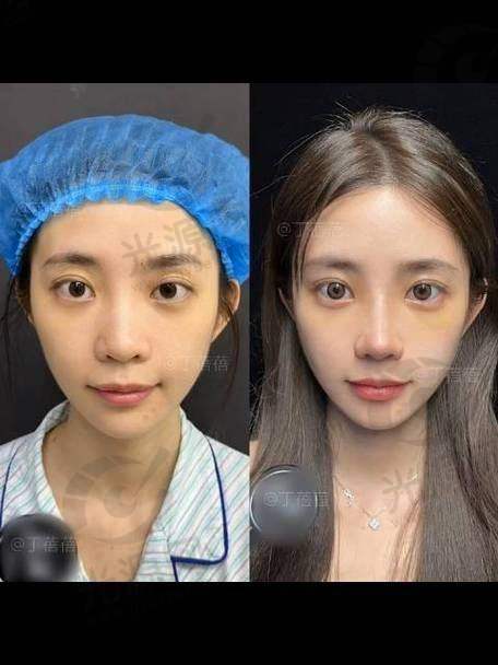 4. 韩国美迪莹整形医院——专注于东方女性美的塑造