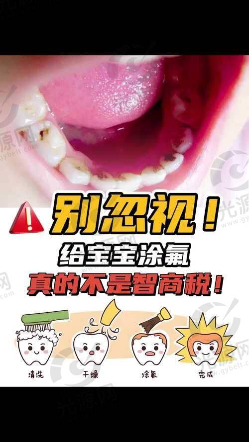 小孩的牙齿涂氟需慎重——涂氟前的准备工作