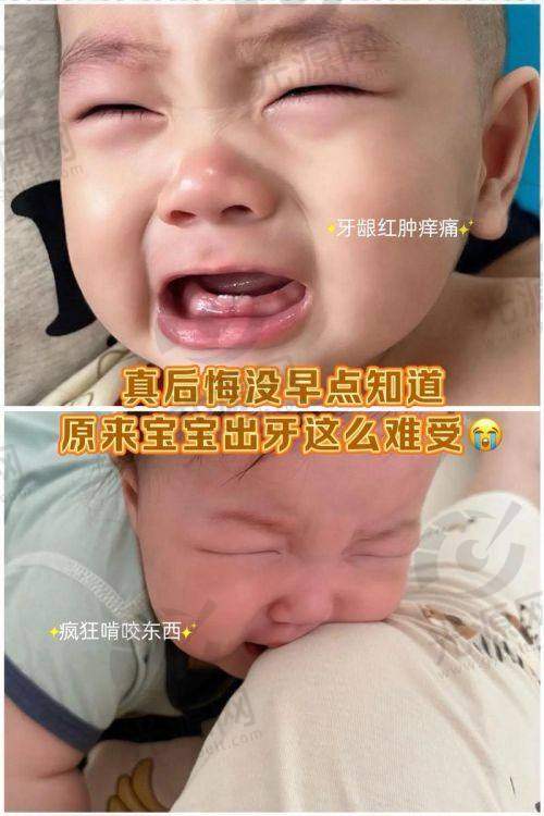 牙龈癌治愈后饮食与生活方式建议
