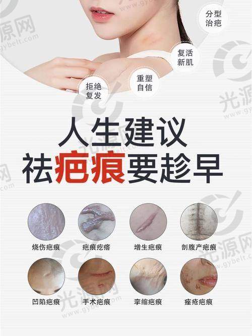 上海九院去除疤痕费用揭秘：多少钱能实现光滑肌肤，专家建议与真实案例分析