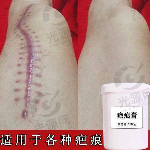 5. 上海九院注射美容（瘢痕胶原诱导）