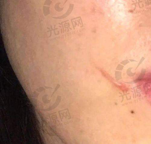 真实用户口碑实例
