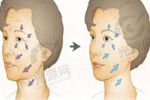 新疆华美整形医院韩式提眉手术排名第2：李天巧医生