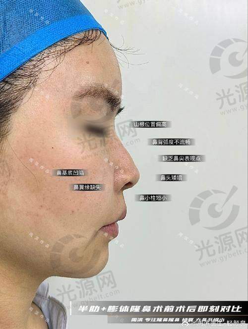 邱少琼医生怎么样：患者口碑