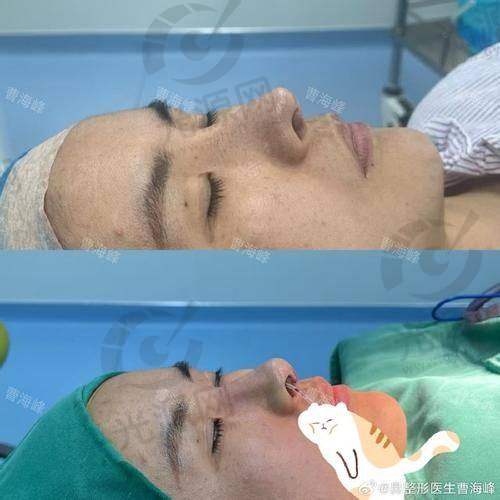 成都出名的做鼻子医生排名第五：李竞