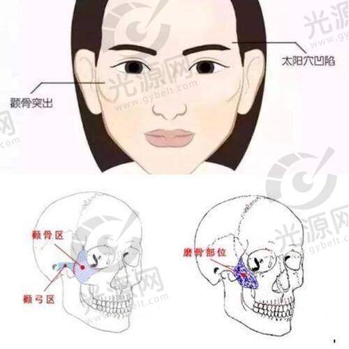日常注意事项与护理