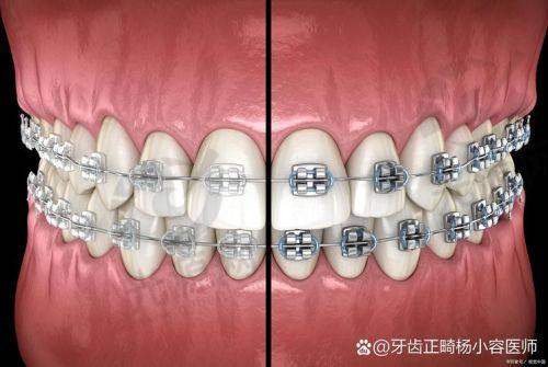 二、武汉牙齿矫正医院排行每家医院的详细介绍