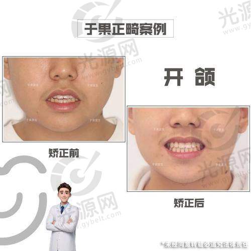 牛立华医生的特色技术