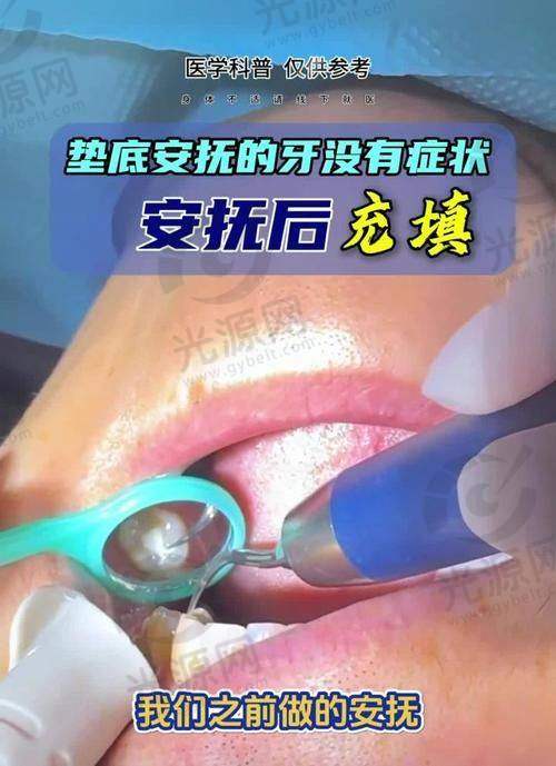 深龋千万不要去补牙的原因
