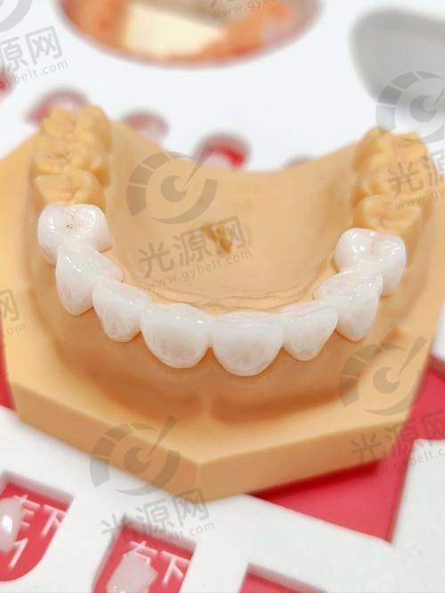 格莱美牙冠材料的优越性
