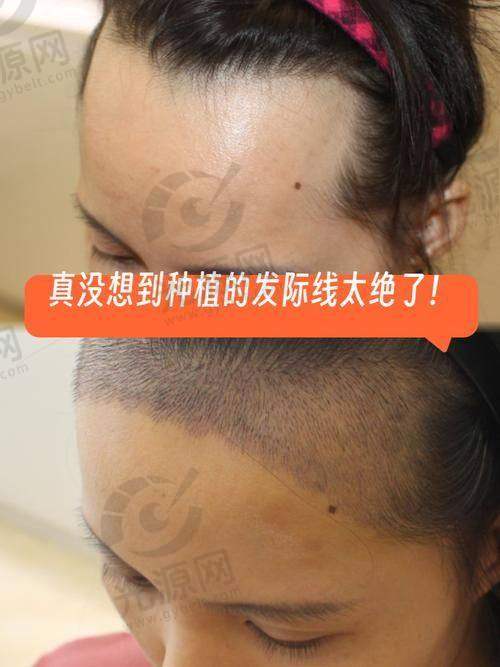 4. 西宁润美整形医院