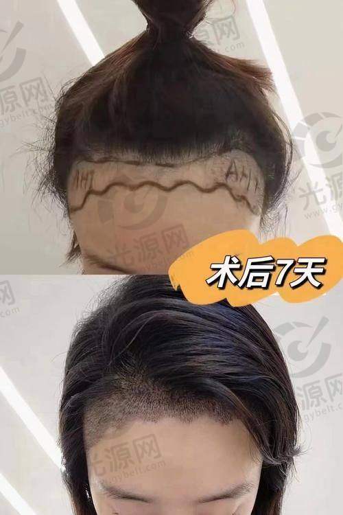7. 青海省人民医院
