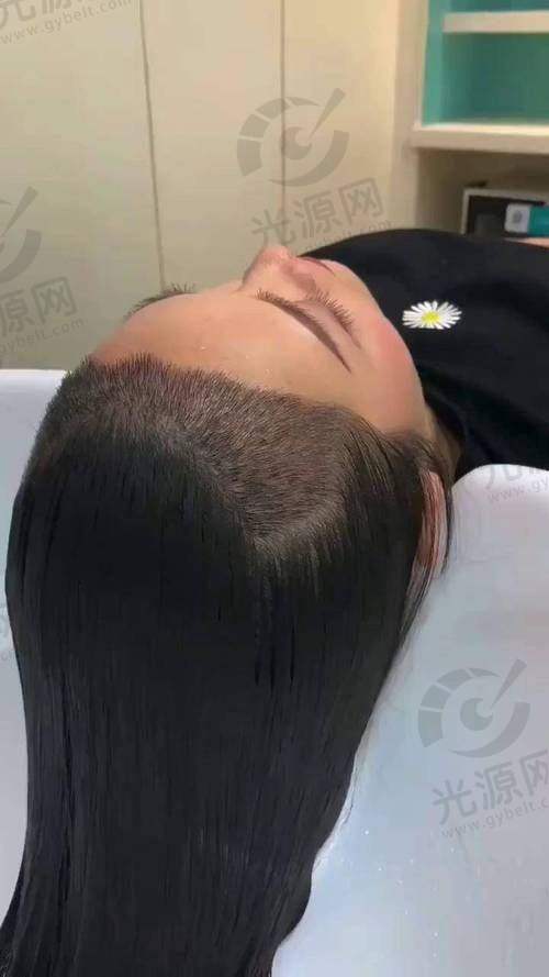 一、广州仁健植发医院，专精可靠的植发专科机构