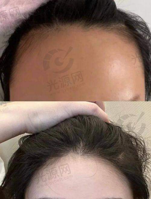 二、西宁植发医院详细介绍