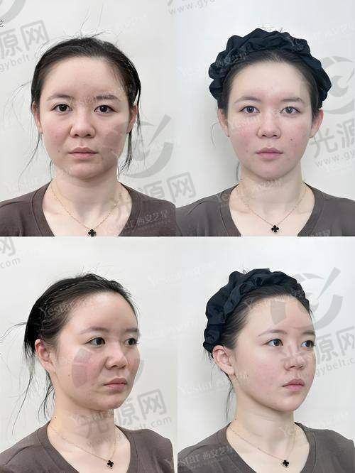 二、沈阳杏林整形医院擅长的项目技术优势