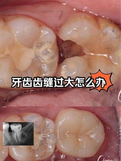 南阳口腔医院该项目技术好不好？