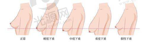 五、在线预约挂号快捷通道攻略