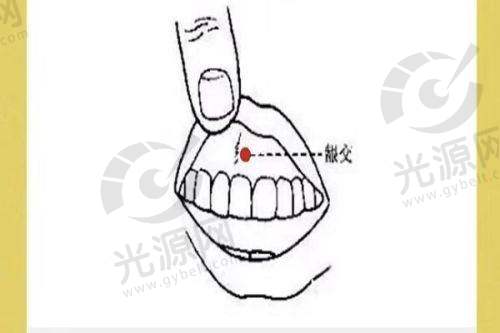 2. 双眼皮手术价格表