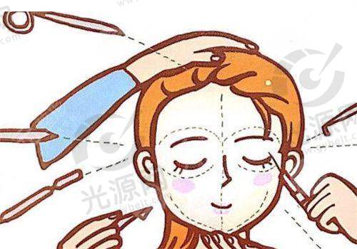 皮秒祛斑10天变化图片的重要性