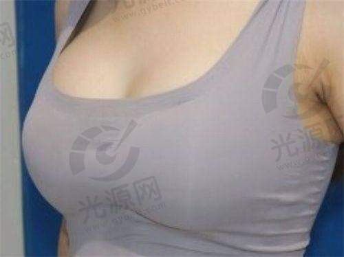 浙江省人民医院美容科电话及服务特色解析，提供高品质医美项目，预约方便，值得信赖！