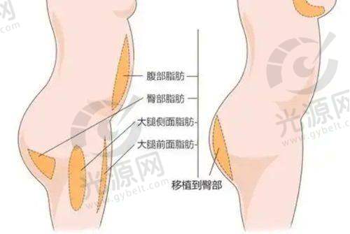 一、广州美杰医疗美容联系方式,详细展开介绍医院资料