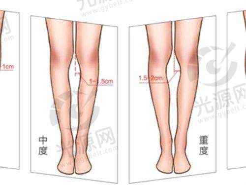 三、上海前十名整形医院项目收费情况