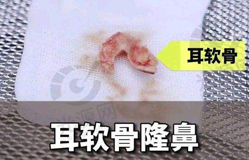 四、大连何栋良整形医院在哪里？