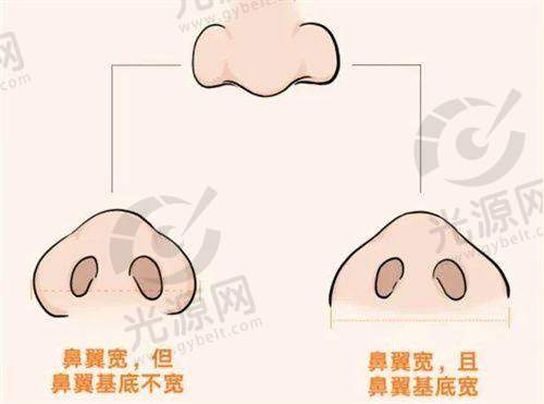 三、医院口碑如何？不妨来看集美们的实例评价