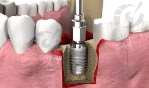 三、汉中小虎牙口腔医院的顾客评价