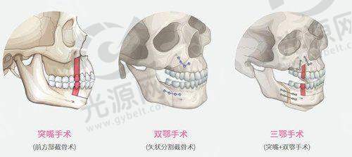 7. 重庆米兰柏羽时光整形美容医院 - 提供多元化美丽解决方案
